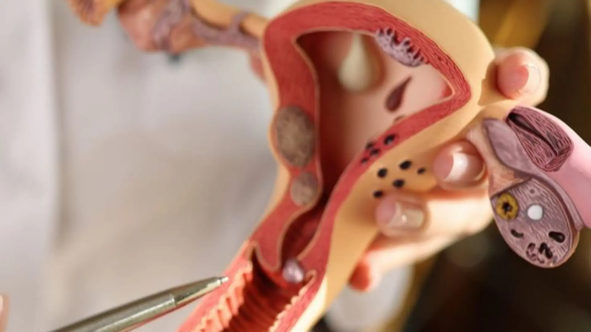 Adolescent Gynecology